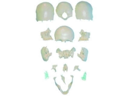 分离头颅骨散骨模型