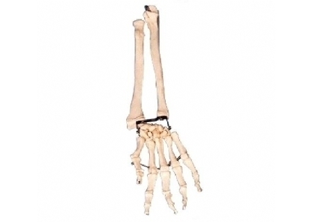 手臂骨带尺骨与挠骨模型