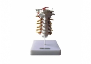 颈椎模型